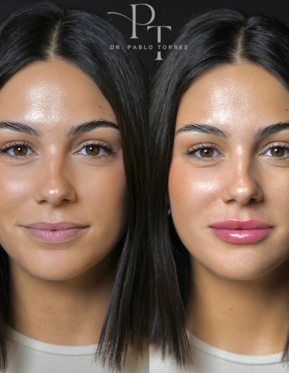 Imagenes Artículo (13)